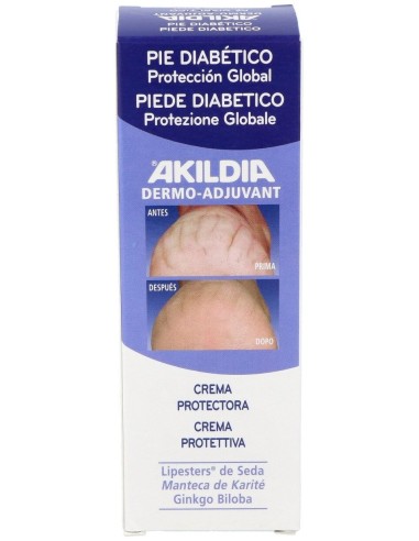 Akildia Crema Pie Del Diabetico 75Ml.